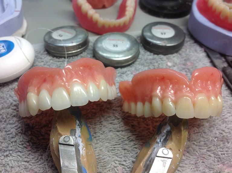 Material Types Dentures Oral Art Dental